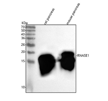 RNASE1 Rabbit Polyclonal Antibody