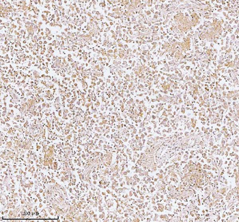 PLBD2 Rabbit Polyclonal Antibody