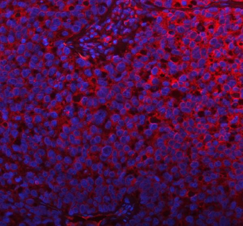 PLBD2 Rabbit Polyclonal Antibody