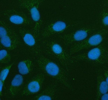 PLBD2 Rabbit Polyclonal Antibody