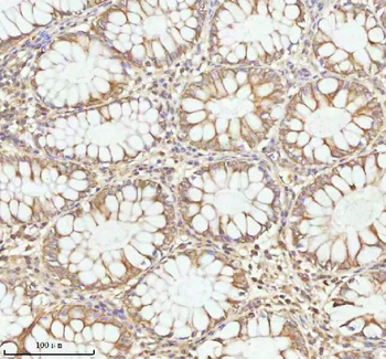 PLBD2 Rabbit Polyclonal Antibody