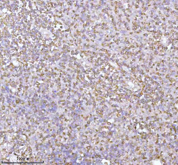 PLBD2 Rabbit Polyclonal Antibody