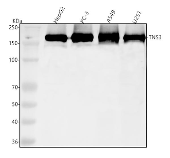 TNS3 Rabbit Polyclonal Antibody