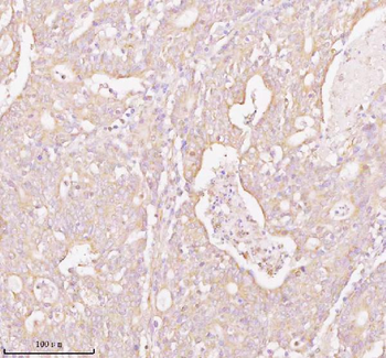TNS3 Rabbit Polyclonal Antibody