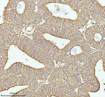 TNS3 Rabbit Polyclonal Antibody
