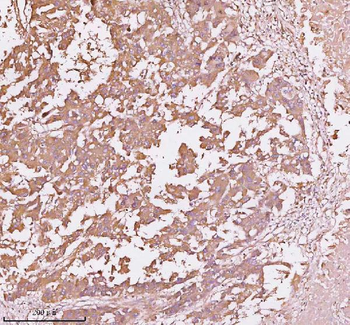 TNS3 Rabbit Polyclonal Antibody