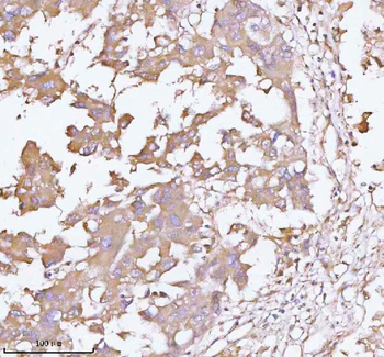TNS3 Rabbit Polyclonal Antibody