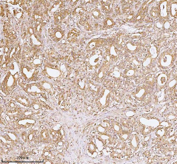 TNS3 Rabbit Polyclonal Antibody