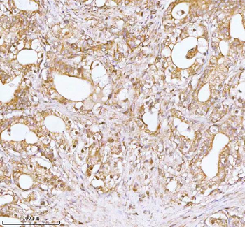TNS3 Rabbit Polyclonal Antibody