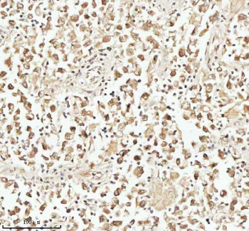 PITHD1 Antibody