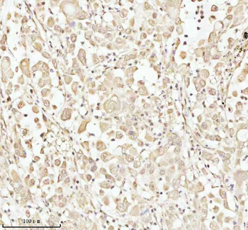 PITHD1 Antibody