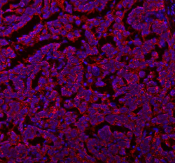 SLC7A7 Rabbit Polyclonal Antibody