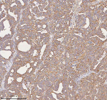 SLC7A7 Rabbit Polyclonal Antibody