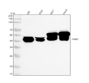 LPAR5 Rabbit Polyclonal Antibody