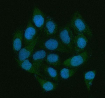 LGALS3BP Rabbit Polyclonal Antibody