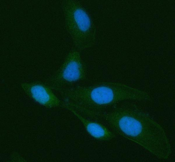 LGALS3 Rabbit Polyclonal Antibody