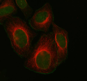 FOXM1 Rabbit Polyclonal Antibody