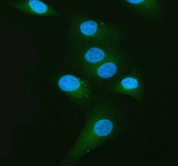 MLPH Rabbit Polyclonal Antibody