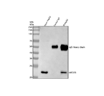MED28 Rabbit Polyclonal Antibody