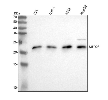 MED28 Rabbit Polyclonal Antibody