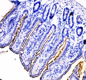 MEP1B Rabbit Polyclonal Antibody