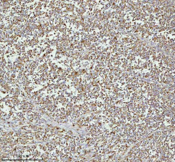 MELTF Rabbit Polyclonal Antibody