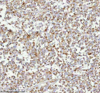 MELTF Rabbit Polyclonal Antibody