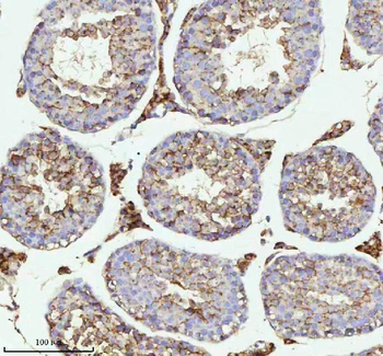 MELTF Rabbit Polyclonal Antibody