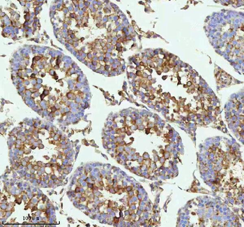 MELTF Rabbit Polyclonal Antibody