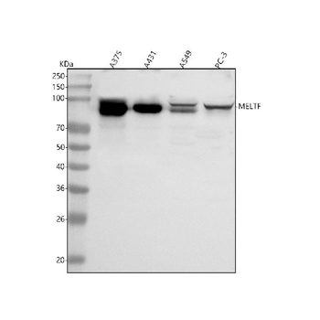 MELTF Rabbit Polyclonal Antibody