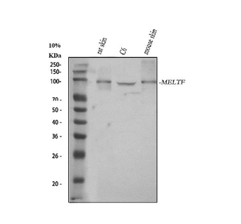 MELTF Rabbit Polyclonal Antibody