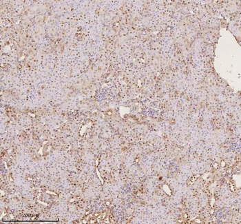 PTRHD1 Rabbit Polyclonal Antibody