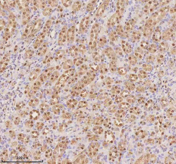 PTRHD1 Rabbit Polyclonal Antibody