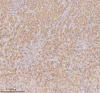 PTRHD1 Rabbit Polyclonal Antibody