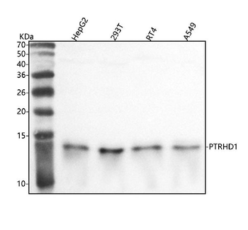 PTRHD1 Rabbit Polyclonal Antibody