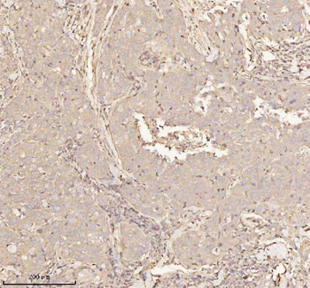 PTCD1 Rabbit Polyclonal Antibody