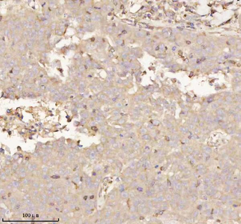 PTCD1 Rabbit Polyclonal Antibody