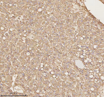 PTCD1 Rabbit Polyclonal Antibody