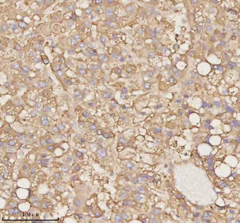 PTCD1 Rabbit Polyclonal Antibody