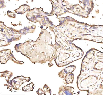 PTCD1 Rabbit Polyclonal Antibody