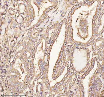 PTCD1 Rabbit Polyclonal Antibody