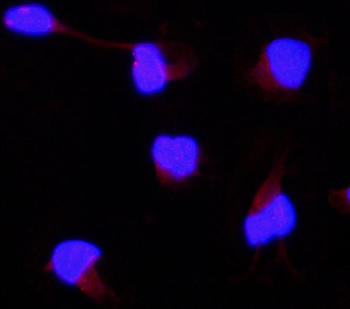 AAMP CCL18 Rabbit Polyclonal Antibody