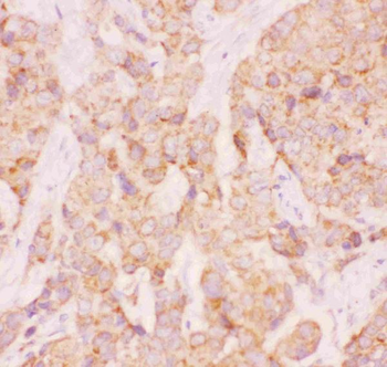AAMP CCL18 Rabbit Polyclonal Antibody