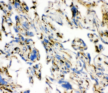Angiotensin Converting Enzyme 1/ACE Rabbit Polyclonal Antibody