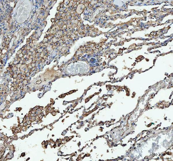 Angiotensin Converting Enzyme 1/ACE Rabbit Polyclonal Antibody