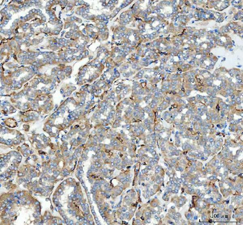 Angiotensin Converting Enzyme 1/ACE Rabbit Polyclonal Antibody