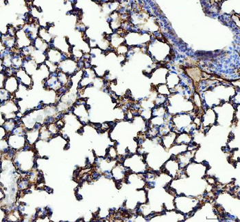 Angiotensin Converting Enzyme 1/ACE Rabbit Polyclonal Antibody