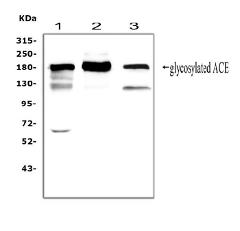 Angiotensin Converting Enzyme 1/ACE Rabbit Polyclonal Antibody