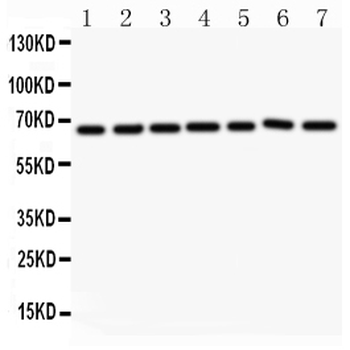 Angiopoietin 1/ANGPT1 Rabbit Polyclonal Antibody