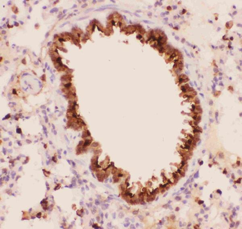 Annexin A1/ANXA1 Rabbit Polyclonal Antibody